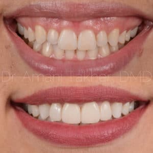 Vacaville Cosmetic Dentist Amani Takher Dmd 1 300x300